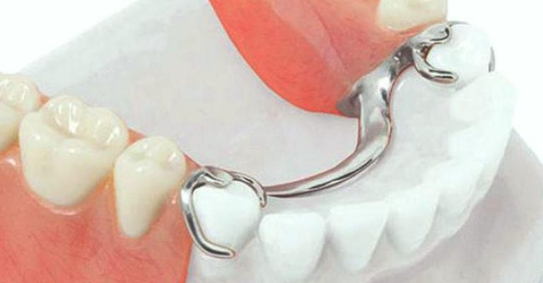 Бюгельный протез Томск Мичурина лазер в детской стоматологии
