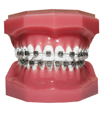 Стоматологии в томске брекеты стоматология на ивана черных томсервис томск