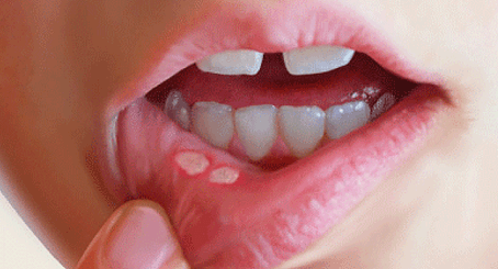 Лечение молочных зубов Томск Центральная